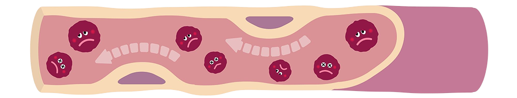 むらさき色の血管の中で悲しそうな表情をした赤い血球が流れている様子