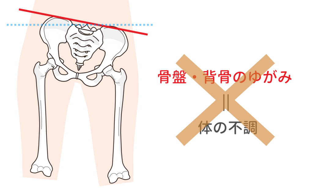 骨盤や背骨のゆがみは体の不調と関係ない
