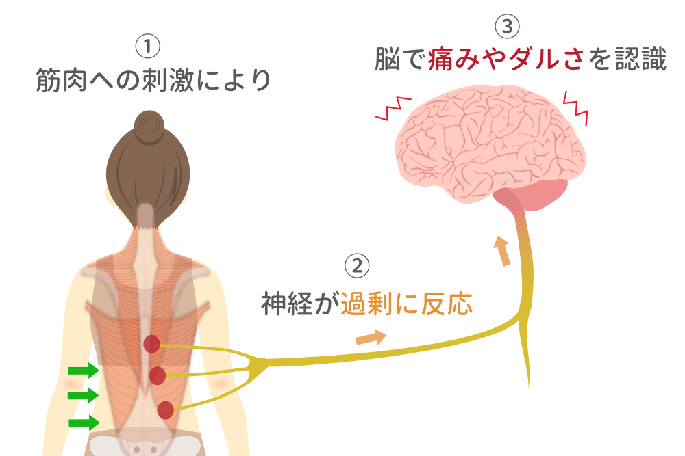 背中の筋肉への刺激が神経を通じて脳に伝わり痛みやだるさを感じる仕組みを示したイラスト