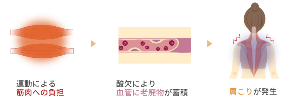 運動による筋肉への負担から酸欠が起こり肩こりが発生する流れを説明する図