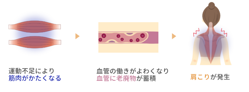 運動不足で筋肉がかたくなり血流が悪くなって老廃物がたまり肩こりが起こる流れを示した図