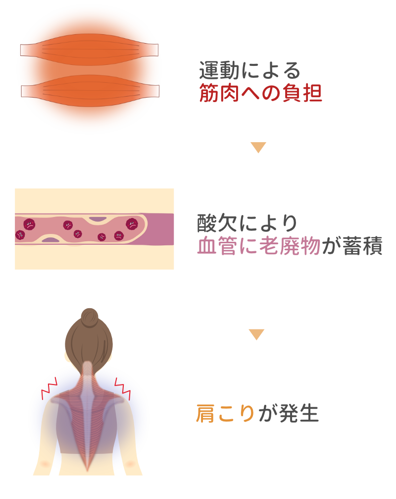 運動による筋肉への負担から肩こりが発生するまでの流れを示す図