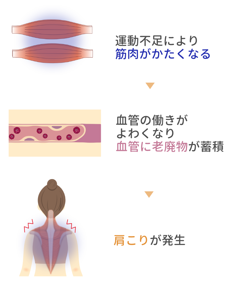 運動不足が原因で筋肉がかたくなり血管に老廃物がたまり肩こりを引き起こす様子を示す図
