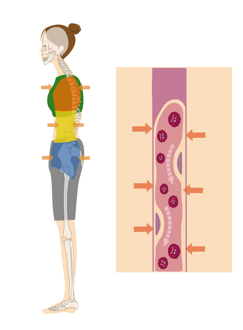 体腔(体内の空間)が狭いため、リンパ管や血管が圧迫されている